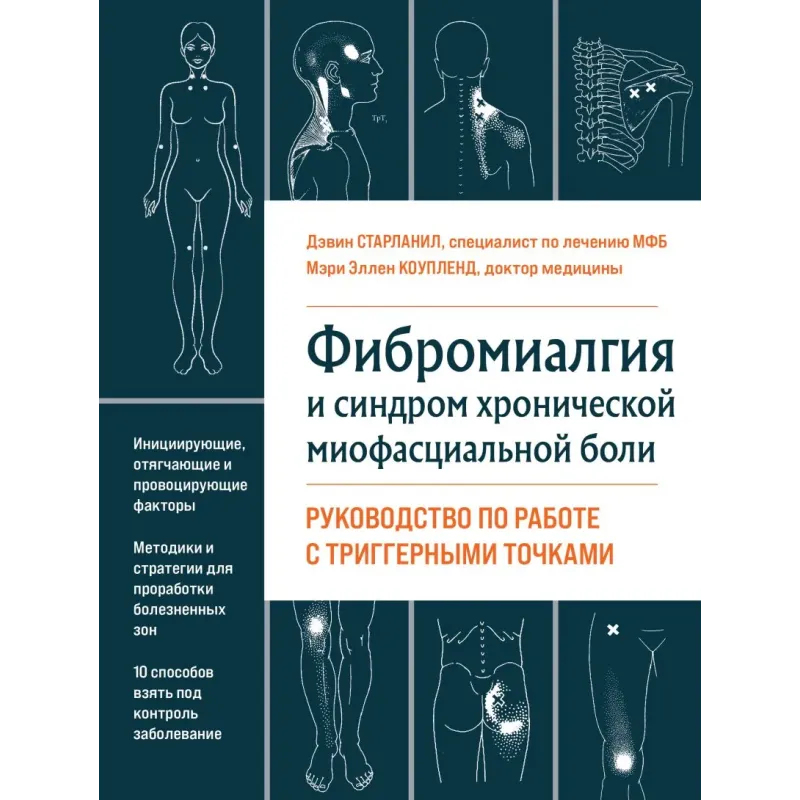 Фибромиалгия и синдром хронической миофасциальной боли. Руководство по работе с триггерными точками