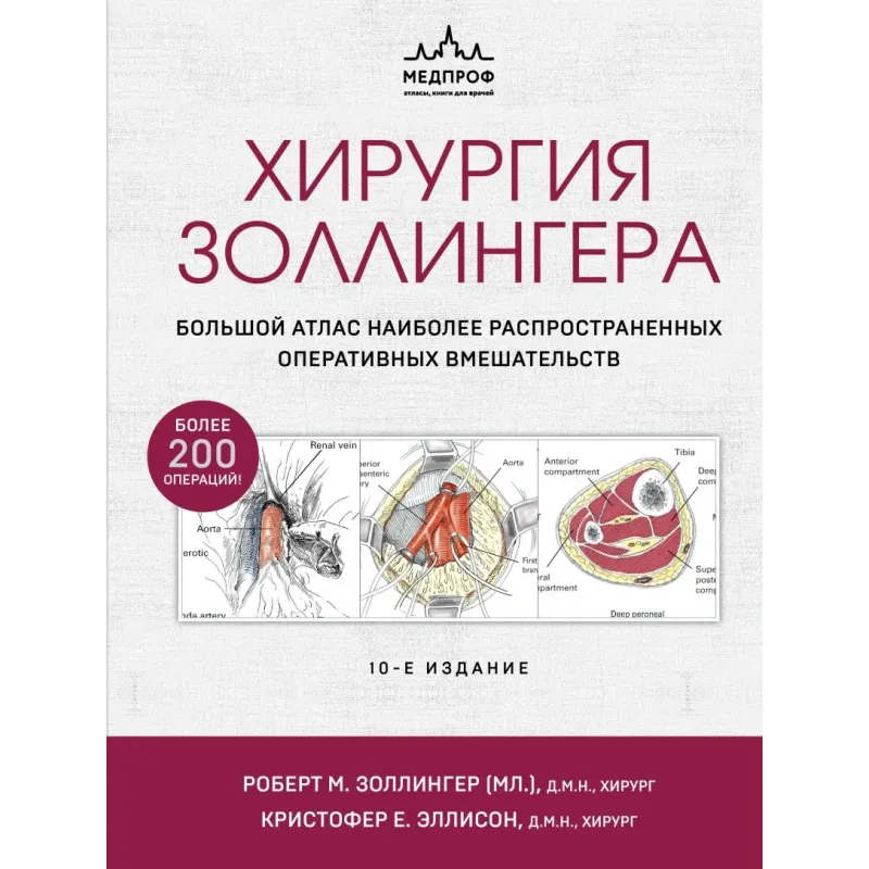 Хирургия Золлингера. Большой атлас наиболее распространенных оперативных вмешательств