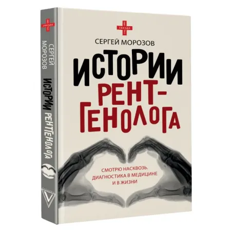 Истории рентгенолога. Смотрю насквозь диагностика в медицине и в жизни.