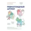 Ревматоидный артрит. Эффективная система питания, позволяющая снизить интенсивность ревматических заболеваний