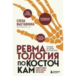 Ревматология по косточкам. Симптомы, диагнозы, лечение