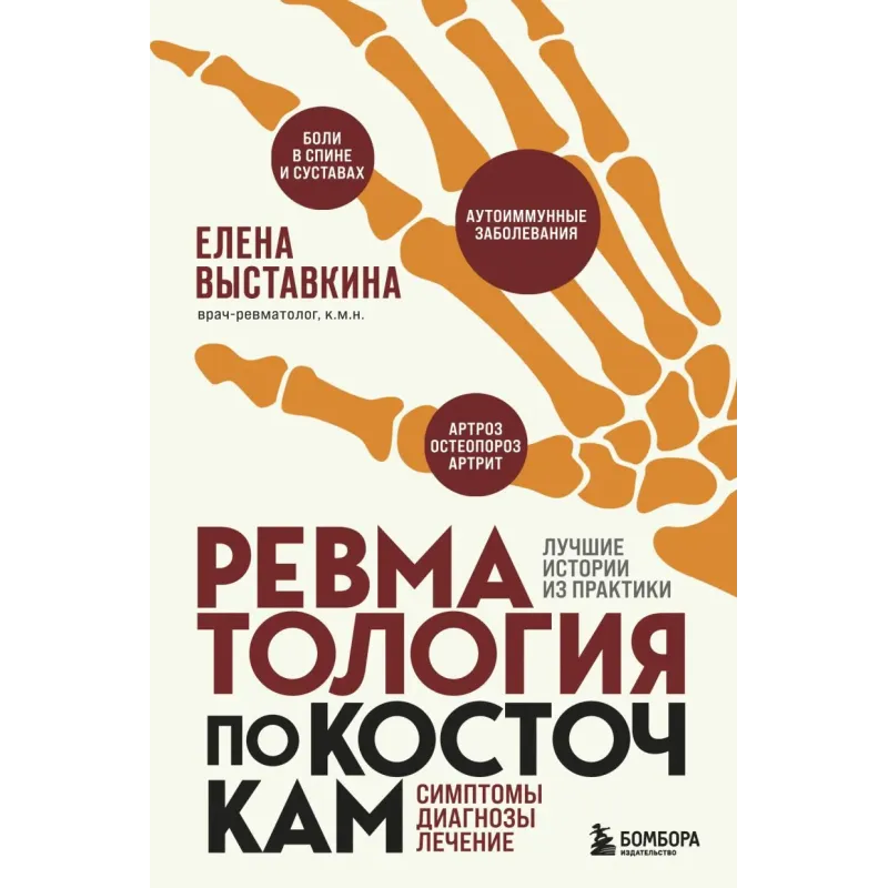 Ревматология по косточкам. Симптомы, диагнозы, лечение